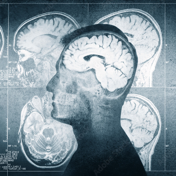 ماجستير التصوير الطبي