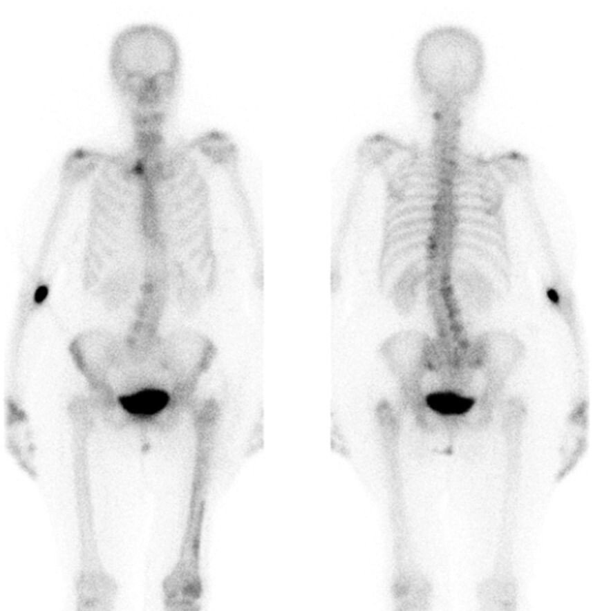 علوم الطب النووي